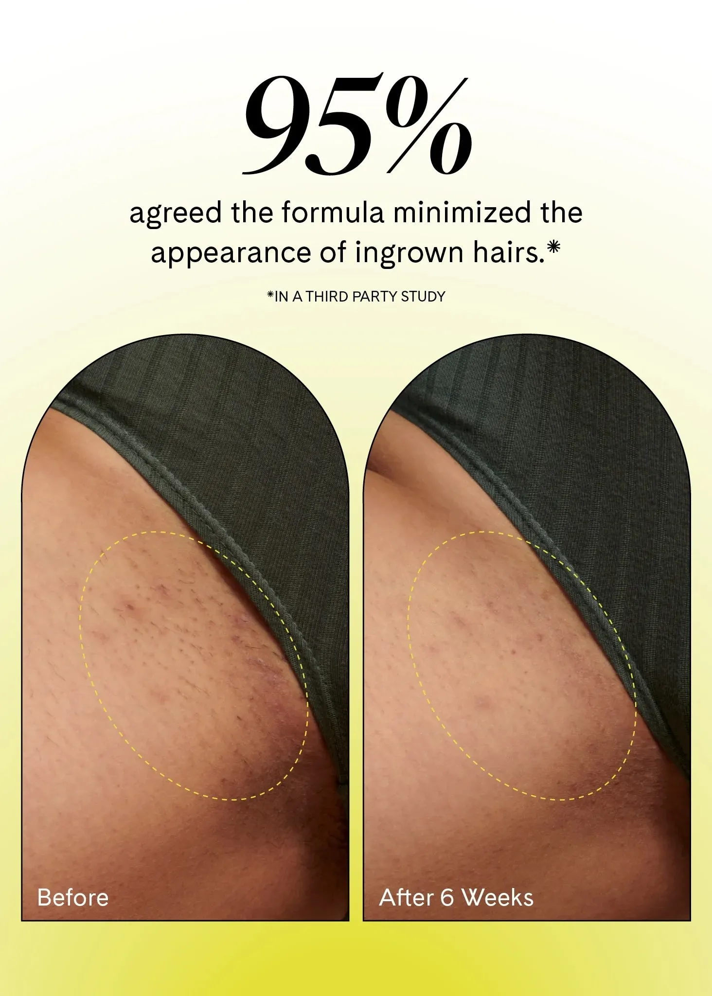 Fur Ingrown Eliminator Serum Rollerball